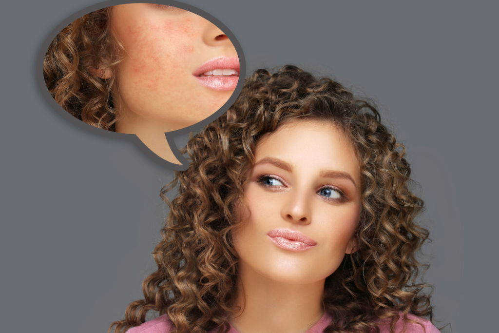 Mulher pensando sobre tratamento para cicatriz de acne na região do rosto