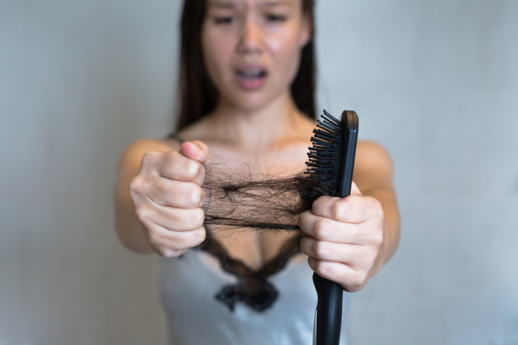 Pessoa mostrando escova com fios soltos, precisando de tratamento para queda de cabelo