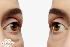 tratamento para área dos olhos (capa)